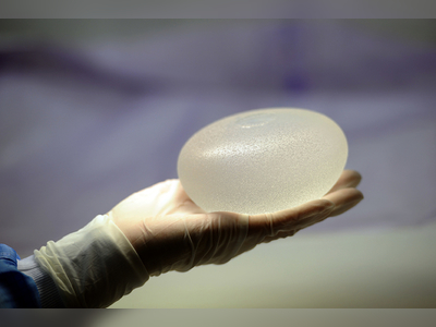 Their Breast Implants Were Recalled Over A Cancer Link. Finding Out If They’re Sick Has Been “Hell.”