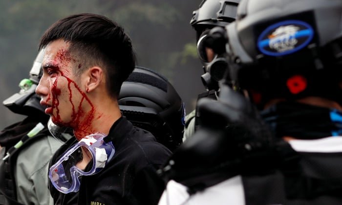 The Guardian: Hong Kong has declared war against its young people