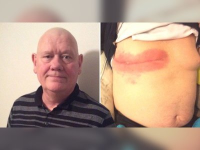 Dad with breast cancer 'rejected from support groups because he's a man'