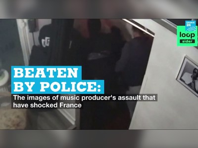 Beaten by police: The images of music producer's assault that have shocked France