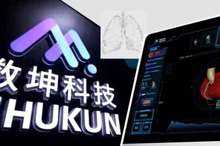 Computer-Assisted Diagnostics Firm Shukun Files for Hong Kong Listing