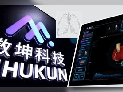 Computer-Assisted Diagnostics Firm Shukun Files for Hong Kong Listing