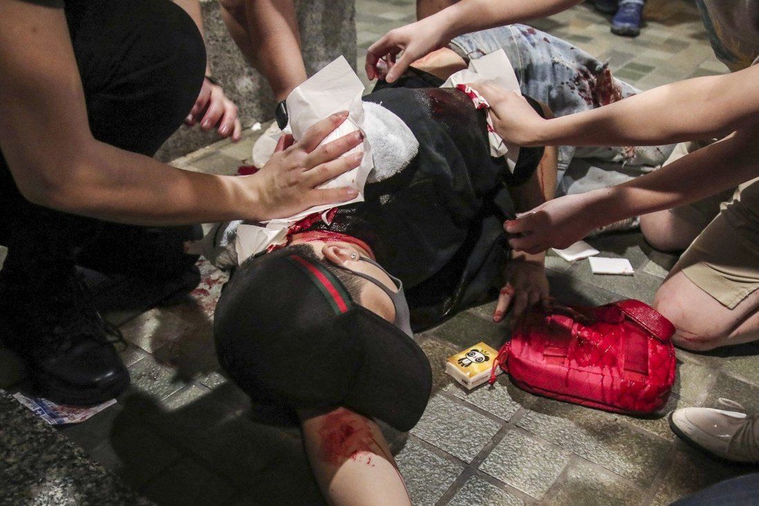 Alleged ear-biter, slasher stands trial in Hong Kong over violence in 2019 unrest