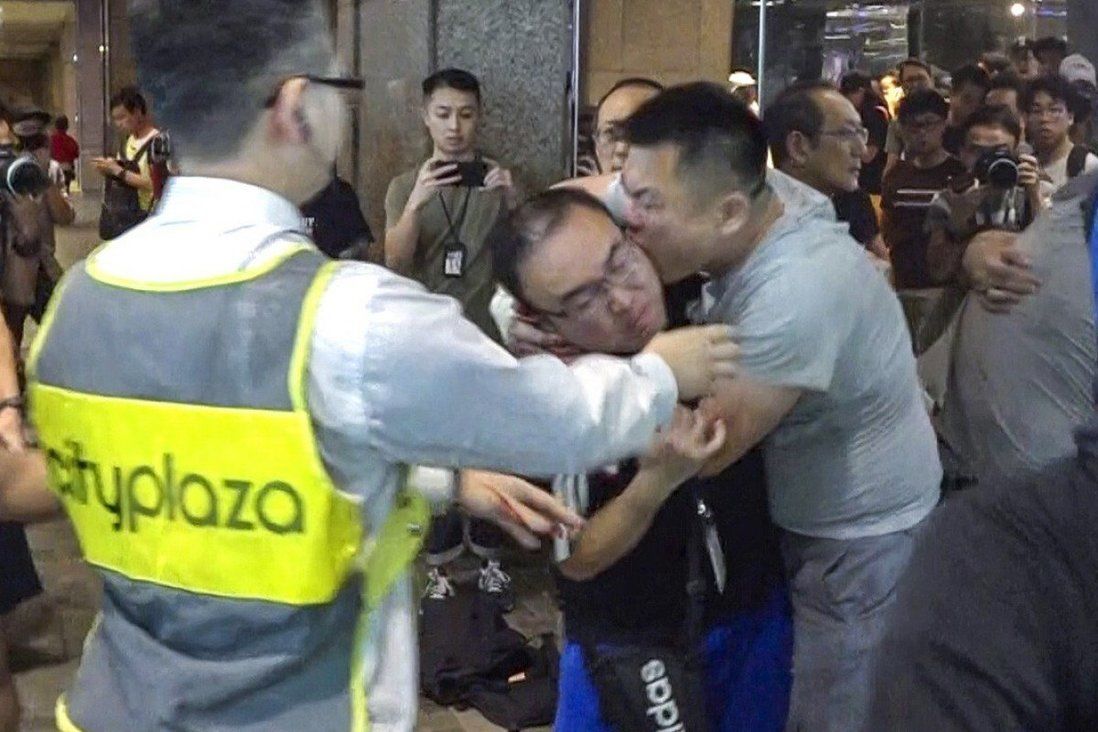 I’ll never forget ‘pluck’ sound of my ear being bitten off: Hong Kong politician