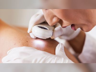 Scientists develop new test that reliably predicts return or spread of deadliest skin cancer