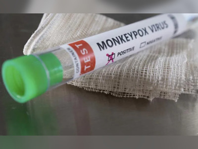 WHO's Emergency Meet To Assess If Monkeypox Global Health Emergency