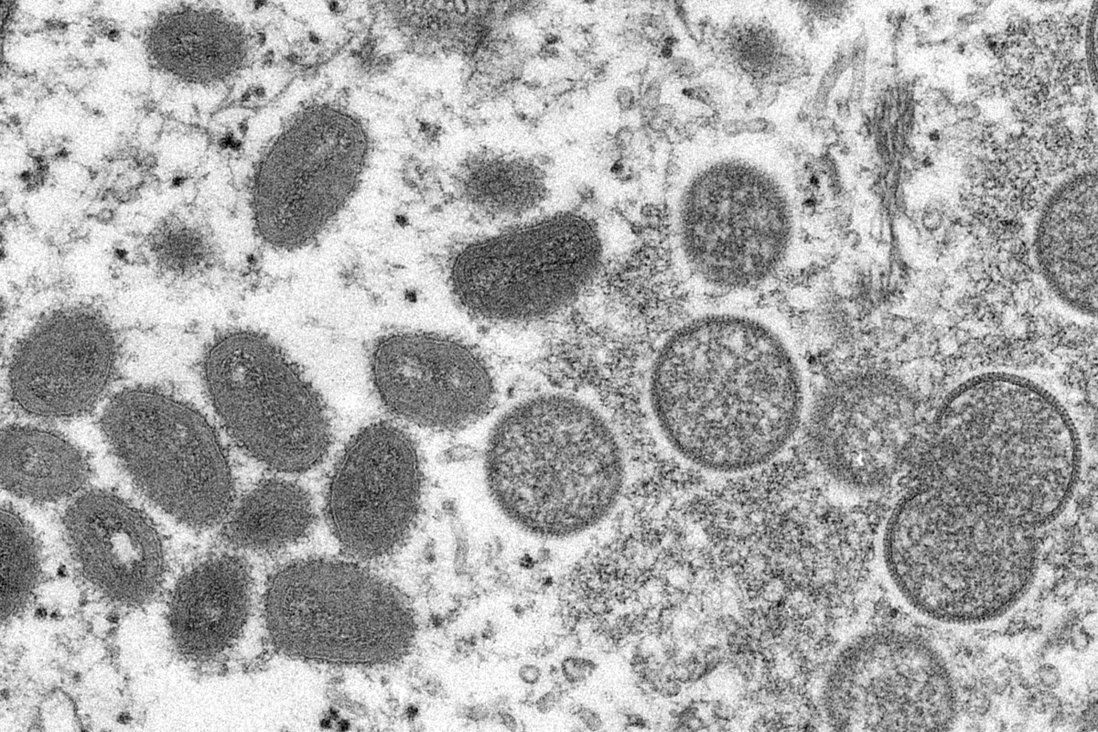 Hong Kong to list monkeypox as statutory notifiable disease next week