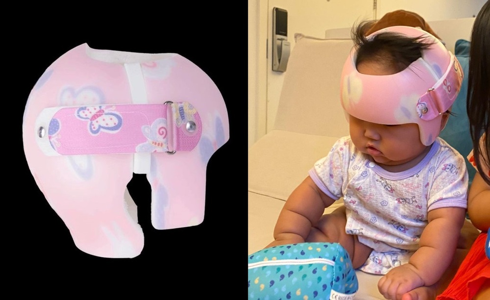 Mother urgently searches for baby' skull-shaping helmet left in taxi