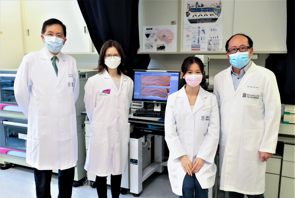 HKU and CityU jointly discover non-invasive stimulation of the eye for depression and dementia