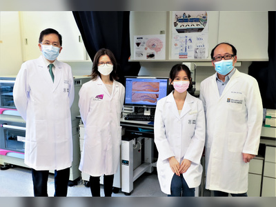 HKU and CityU jointly discover non-invasive stimulation of the eye for depression and dementia