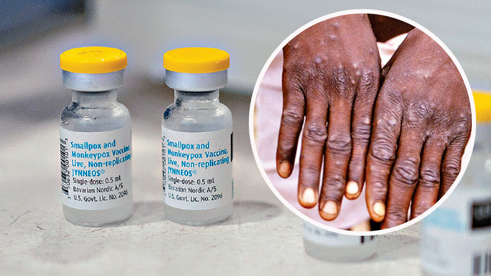 Monkeypox vaccination scheme to commence next month