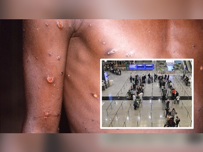 First suspected monkeypox case found in Hong Kong arrival