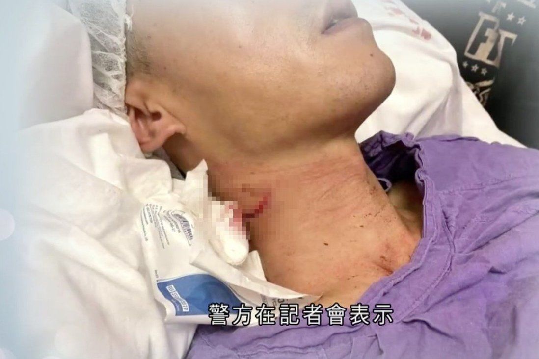 Hong Kong protests: officer seeks damages from school pupil who slashed his neck