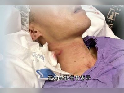 Hong Kong protests: officer seeks damages from school pupil who slashed his neck