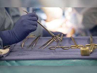 US surpasses 1m organ transplant milestone since first surgery in 1954