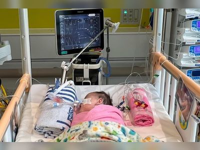 In national first, Hong Kong baby girl receives donated heart from mainland China