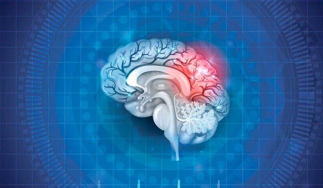 19-Year-Old In China Diagnosed With Alzheimer's Disease