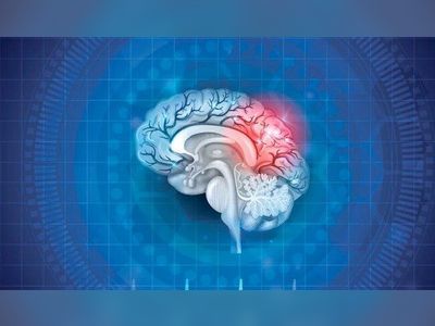 19-Year-Old In China Diagnosed With Alzheimer's Disease