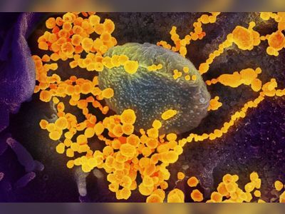 Hong Kong experts say 10-year death rate high not all down to Covid-19