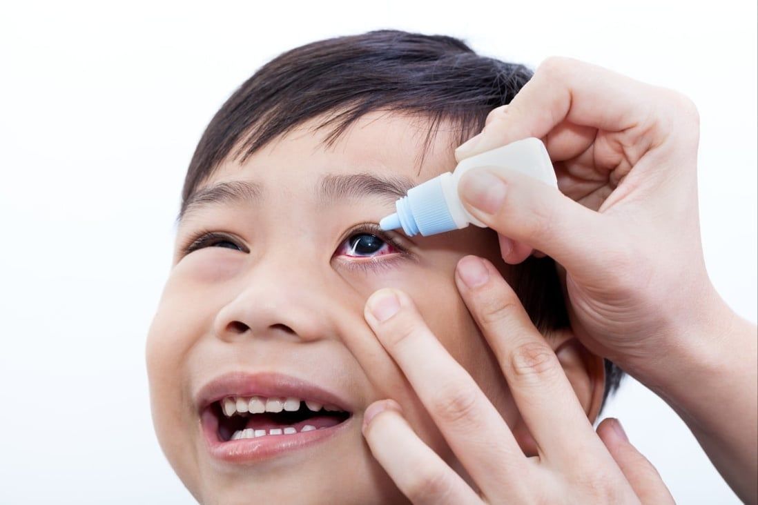 Covid-19 rules contributed to upsurge in myopia in Hong Kong children, study finds